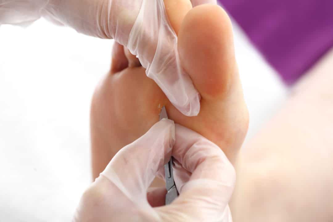 Surgery Foot & Ankle Procedures Eugene Foot & Ankle