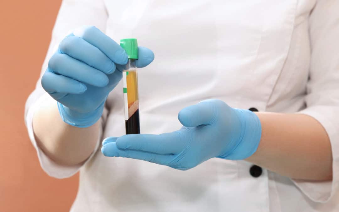 What Is PRP Therapy? A Brief FAQ