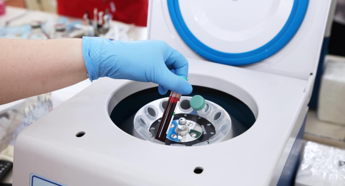Blood vile placed in centrifuge for prp therapy