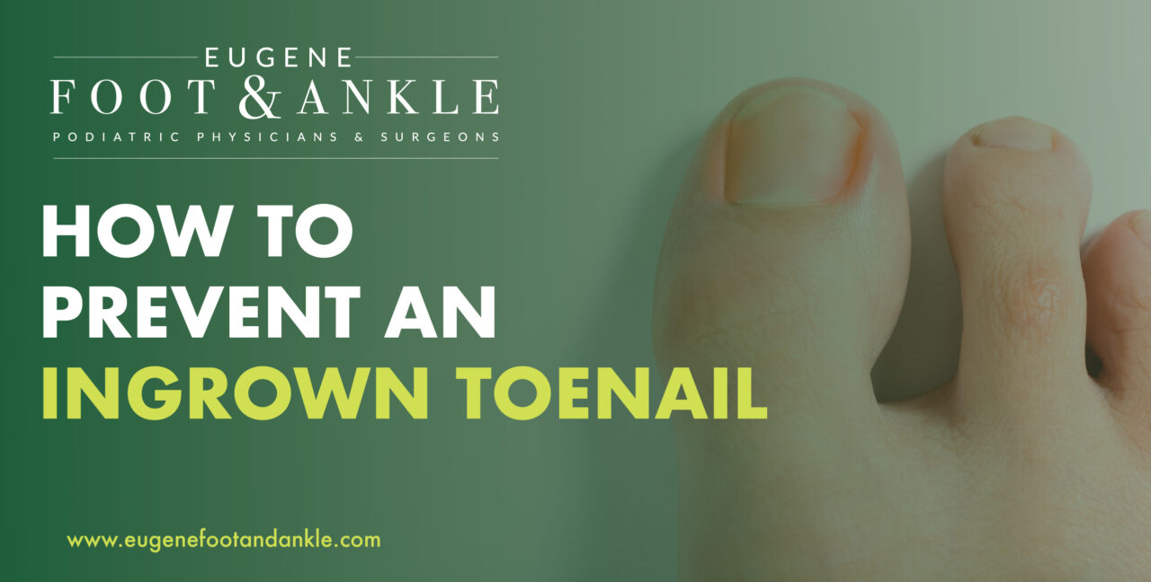 Ingrown Toenail Treatments and Prevention Eugene Foot & Ankle