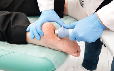 Why Your Podiatrist Might Recommend Extracorporeal Shockwave Therapy