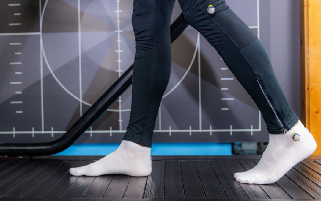 Pronation vs. Supination: How Your Walking Style Affects Your Life