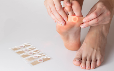 Plantar Warts: What Causes Them and How Are They Treated?