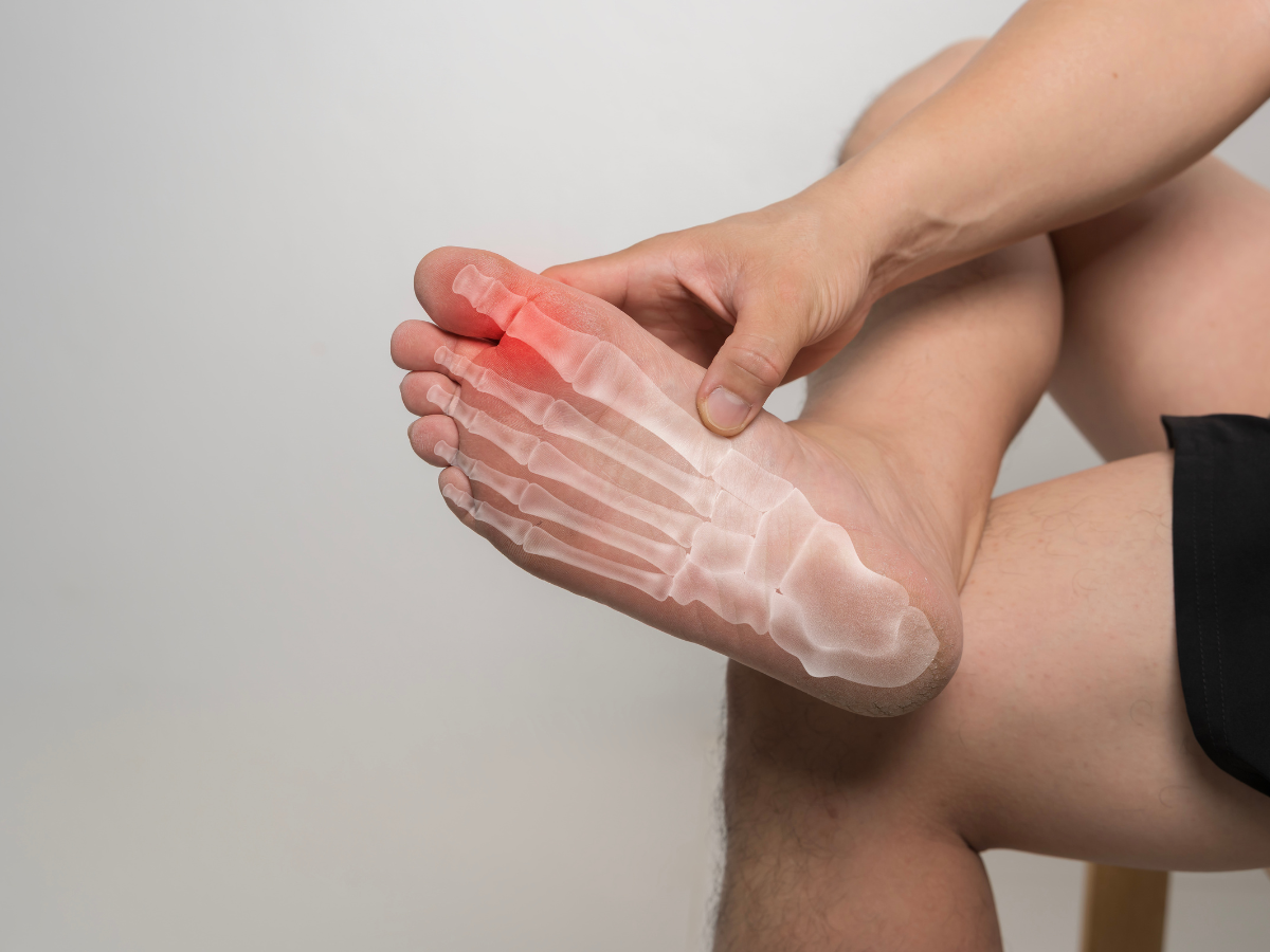 Stress Fracture in the Foot: Signs You Shouldn’t Ignore