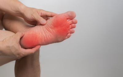 Tarsal Tunnel Syndrome: What Causes Burning or Tingling in Your Feet?