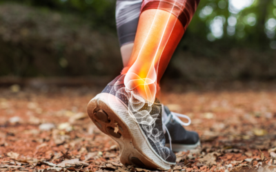 Ankle Arthritis: Causes, Symptoms, and Treatment Options
