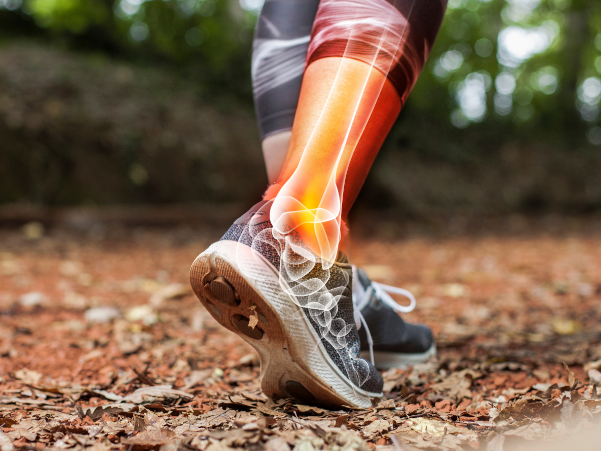 Ankle Arthritis: Causes, Symptoms, and Treatment Options